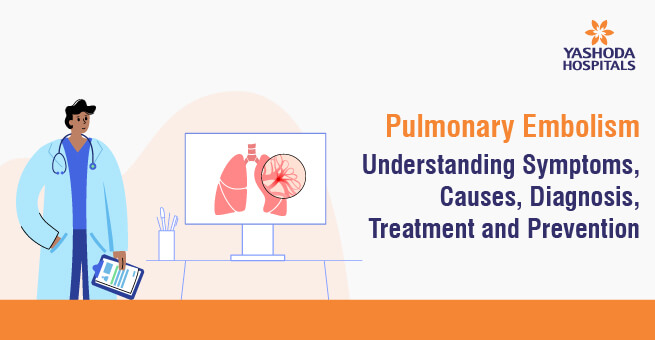 Pulmonary Embolism: Understanding Symptoms, Causes, Diagnosis, Treatment and Prevention