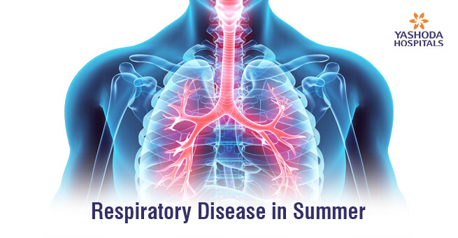 Respiratory Disease in Summer