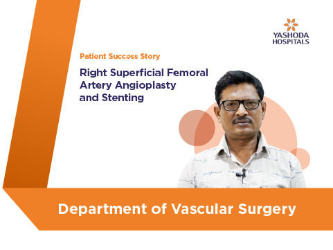 Right Superficial Femoral Artery Angioplasty & Stenting