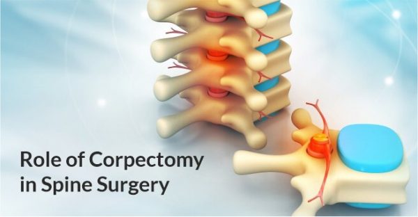 Role Of Corpectomy In Spine Surgery