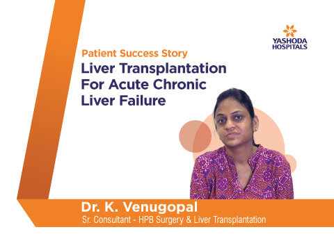 Liver Transplantation for Acute Chronic Liver Failure