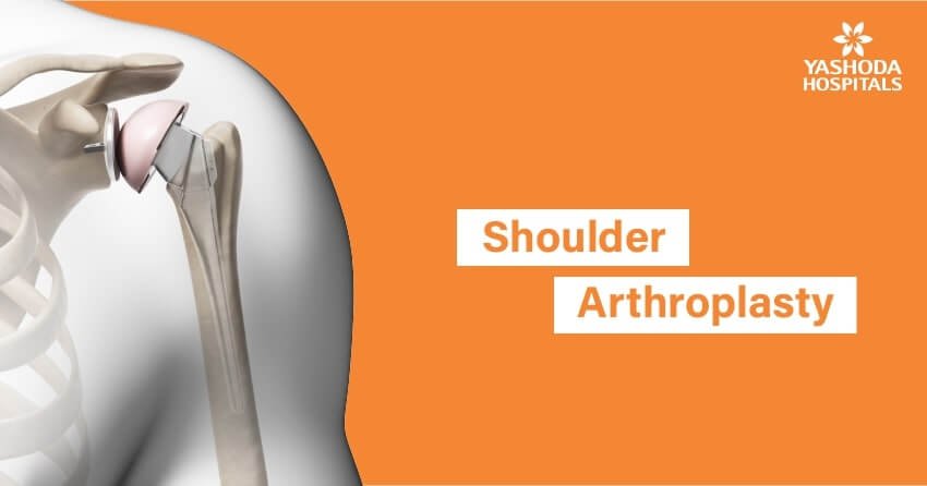 shoulder surgery replacement procedure operation arthroplasty types major since person treatment yashodahospitals