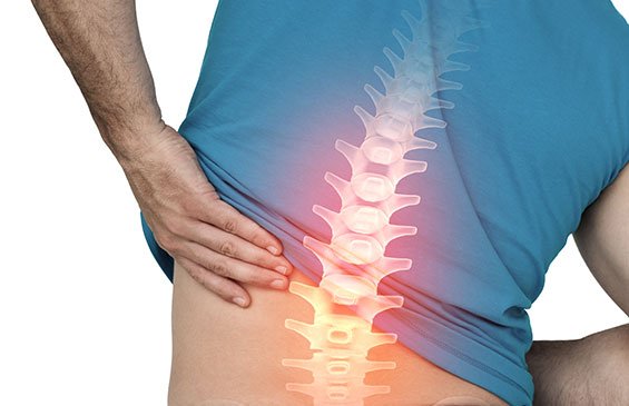 Spinal Fusion Cost in India | Spinal Fusion Cost in Hyderabad