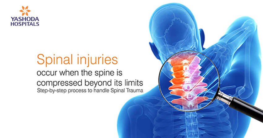 Step-by-step process to handle Spinal Trauma