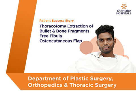Thoracotomy Extraction of Bullet & Bone Fragments Free Fibula Osteocutaneous Flap