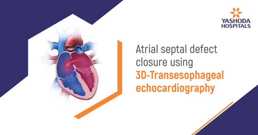 Three dimensional Trans esophageal echocardiography