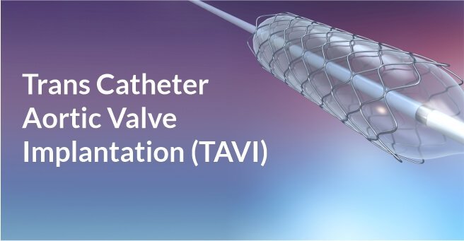 Trans Catheter Aortic Valve Implantation (TAVI)