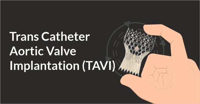 Trans Catheter Aortic Valve Implantation (TAVI)