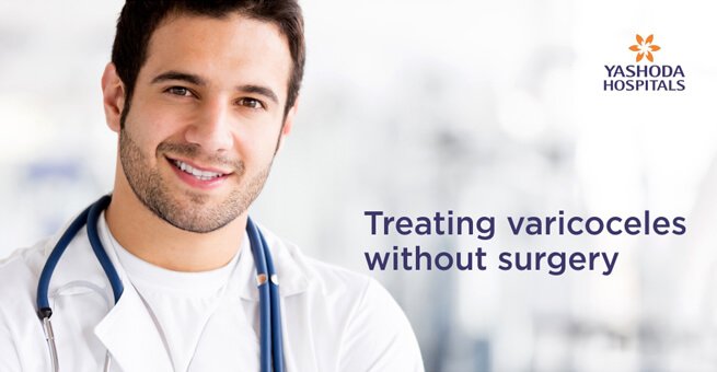 Treating varicoceles without surgery