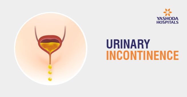 Urinary Incontinence Types Causes Symptoms Diagnosis And Treatment