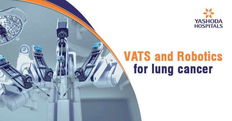 Vats & robotics for lung cancer