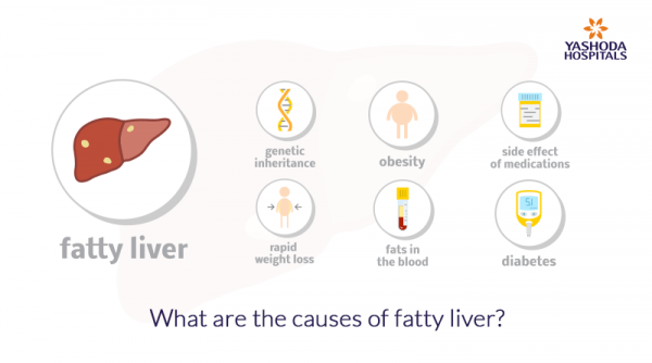 Liver Disease: Symptoms, Causes, Diagnosis and Treatment