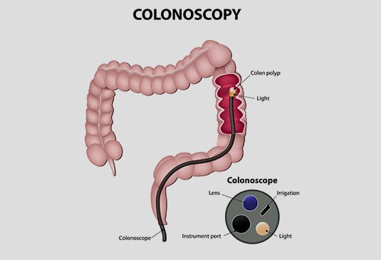 endoscopy test cost in Hyderabad