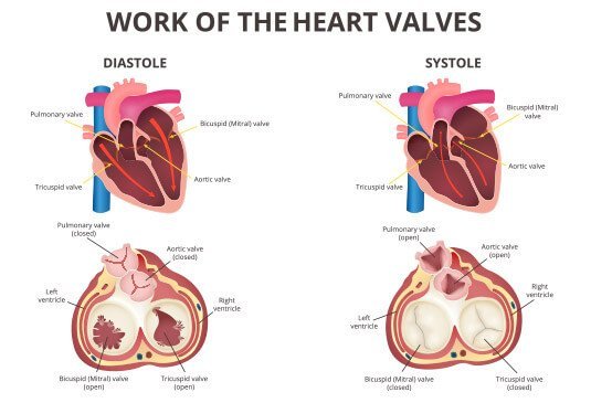 Heart Valve Replacement surgery