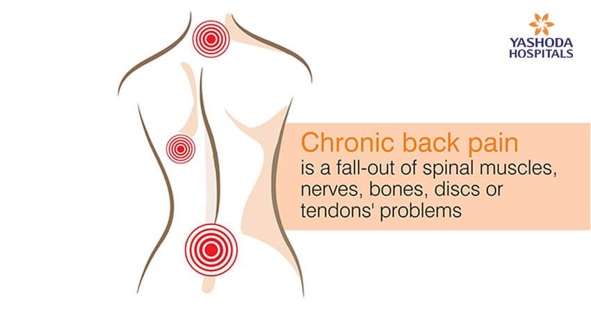Chronic back pain is a fall-out of spinal muscles, nerves, bones