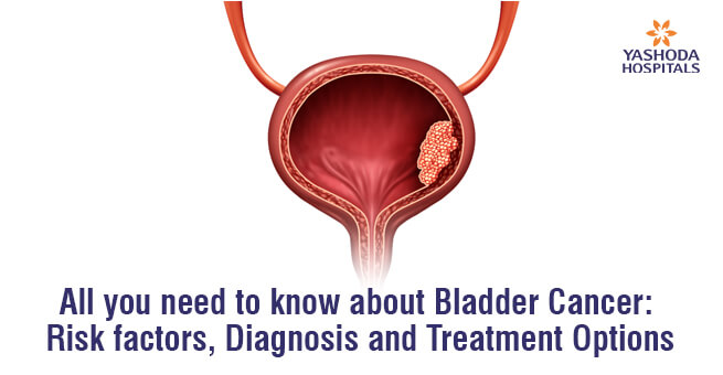 All you need to know about Bladder Cancer: Risk factors, Diagnosis and Treatment Options