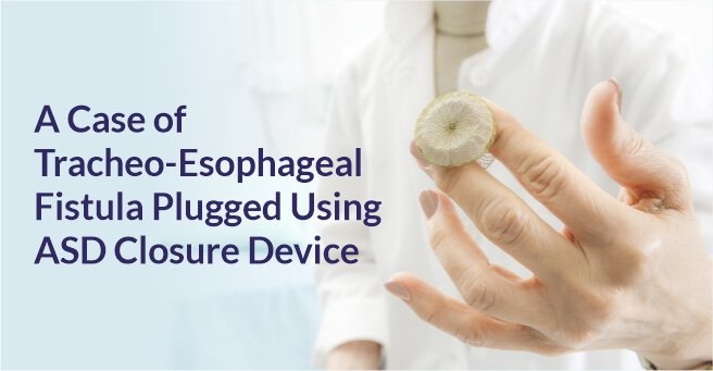 A Case of Tracheo-Esophageal Fistula Plugged Using ASD Closure Device