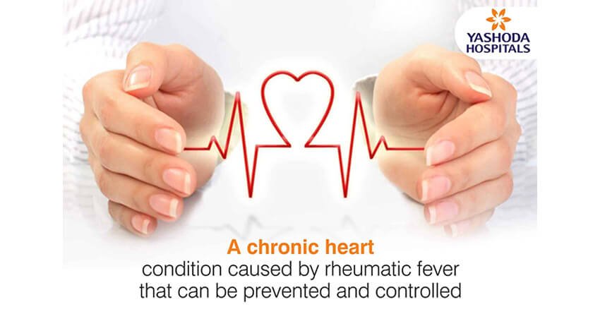 A chronic heart condition caused by rheumatic fever that can be prevented and controlled