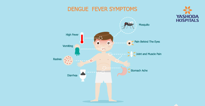 dengue-fever-symptoms