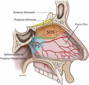 Endoscopic Transsphenoidal Pituitary Surgery with iMRI