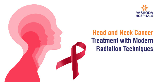 Head and Neck Cancer Treatment with Modern Radiation Techniques