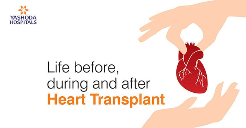 Life before, during and after heart transplant