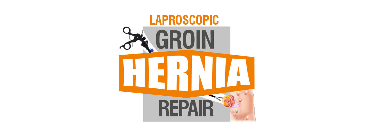laproscopic groin hernia