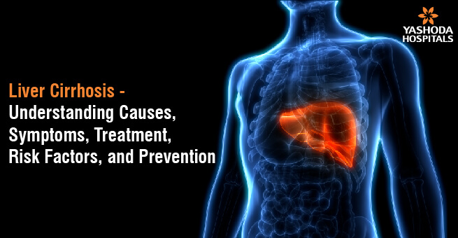Liver Cirrhosis – Understanding Causes, Symptoms, Treatment, Risk Factors, and Prevention