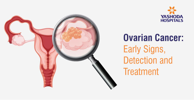 Ovarian Cancer symptoms