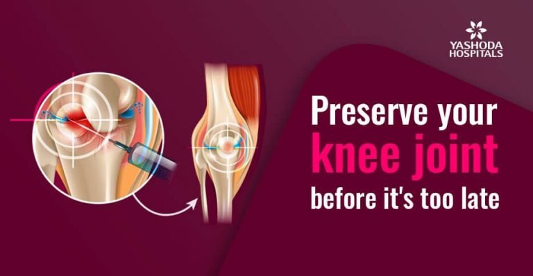 Knee Joint Preservation: Why And How Its Done?