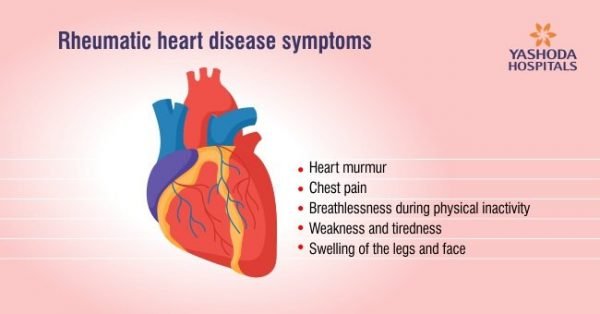 Rheumatic Fever (Acute Rheumatic Fever or ARF): Symptoms, Causes ...