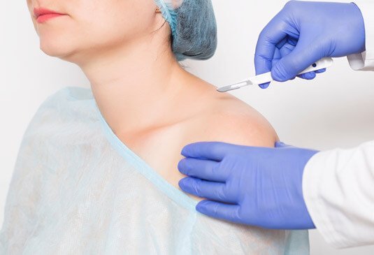 shoulder arthroscopy cost in india hyderabad