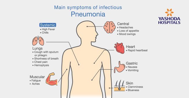 Pneumonia: Types, Causes, Symptoms, Diagnosis and Treatment