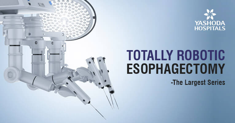 totaly robotic esophagectomy