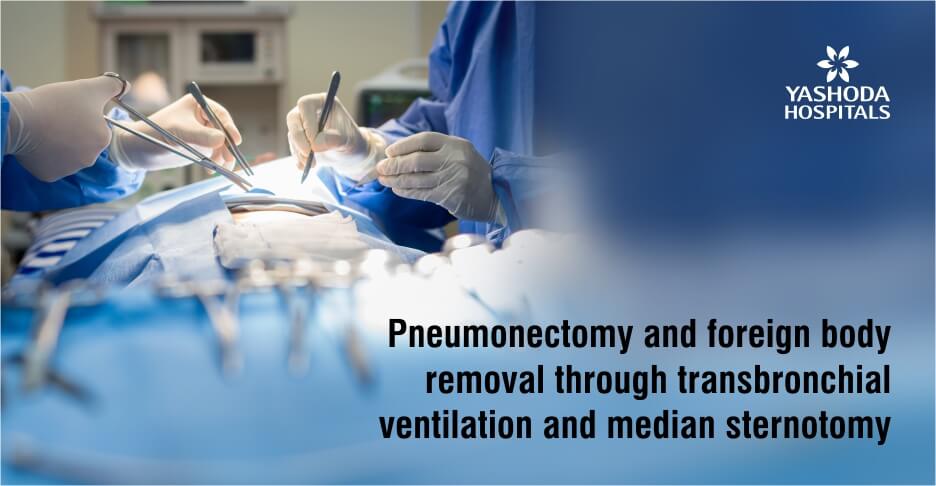 transbronchial ventilation and median sternotomy