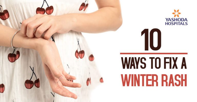 winter-rash-causes-symptoms-treatment-and-prevention